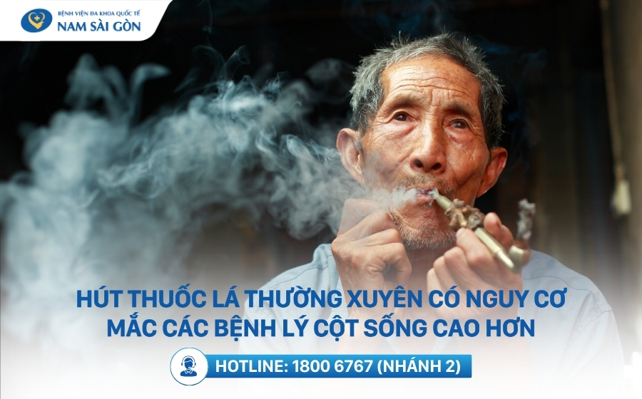 hut-thuoc-la-thuong-xuyen- co-nguy-co-mac-cac-benh-ly-cot-song-cao-hon