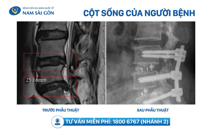 H9 Benh tri ngoai 5