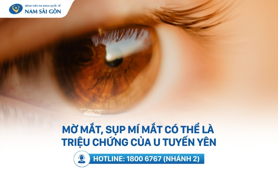 Triệu chứng u tuyến yên