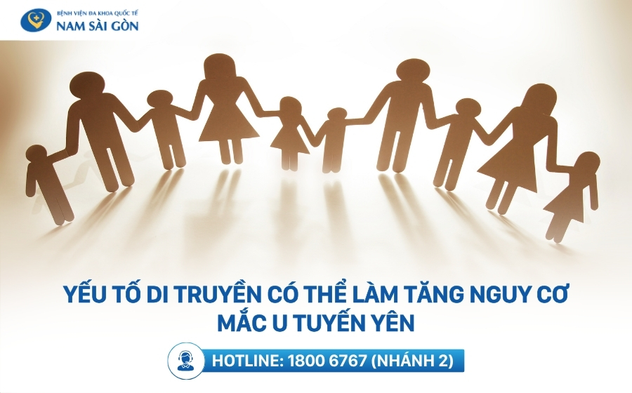 Nguyên nhân u tuyến yên