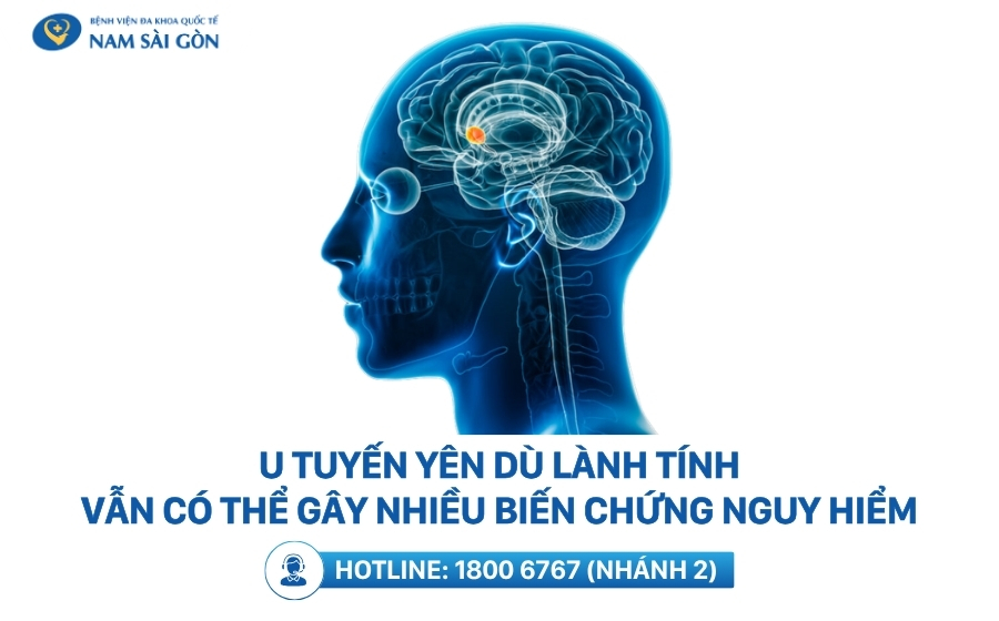 Biến chứng u tuyến yên