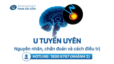 U TUYẾN YÊN LÀ GÌ? NGUYÊN NHÂN, CHẨN ĐOÁN VÀ CÁCH ĐIỀU TRỊ